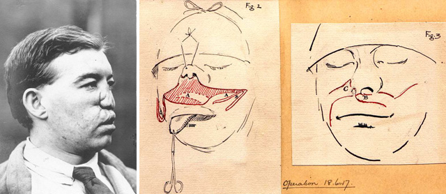 Operation of 18th June 1917